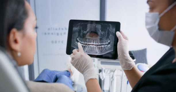 Best Emergency Root Canal Treatment in Britton, SD
